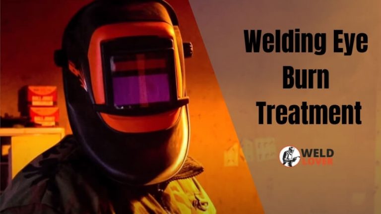 Welding Eye Burn Treatment | Eyesclinic